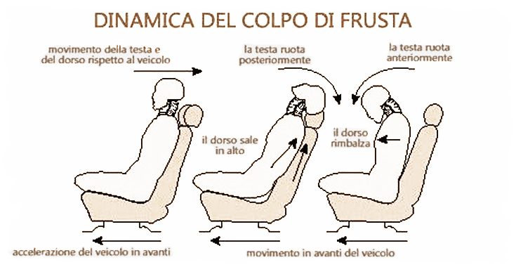 Sintomi del colpo di frusta