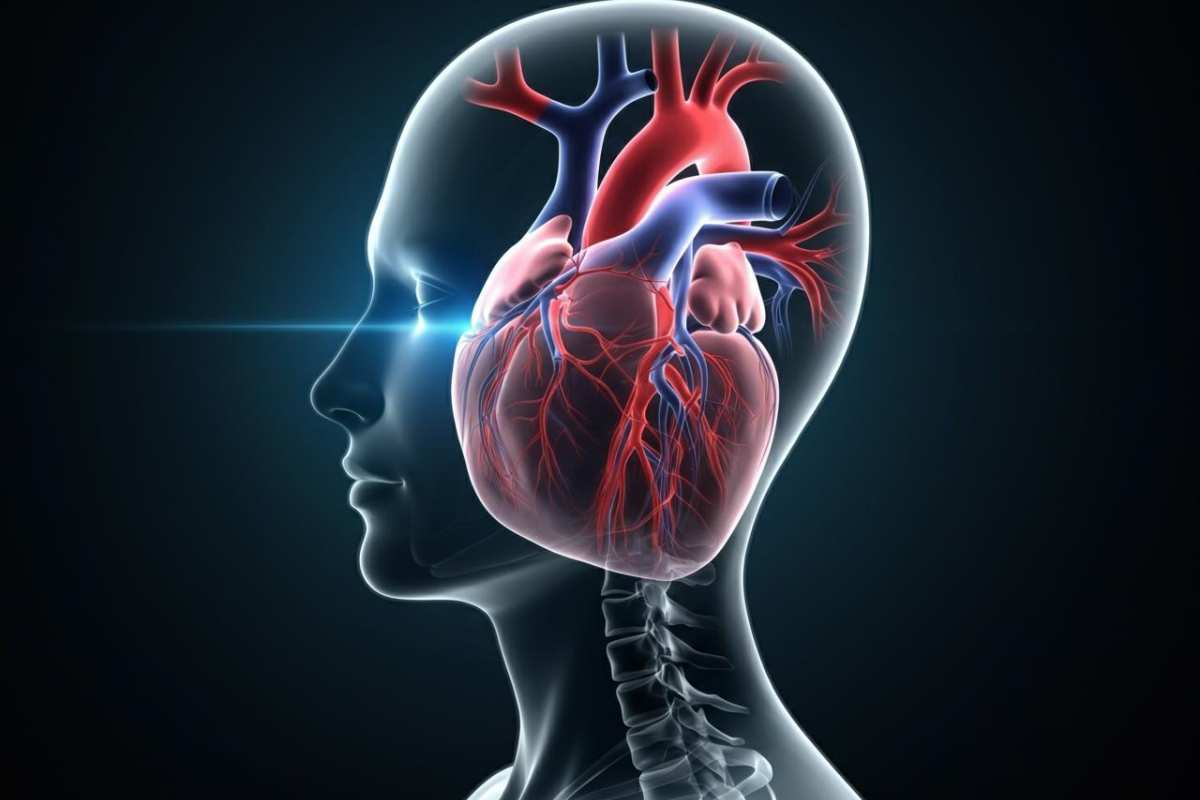 Ictus e infarto, fattore