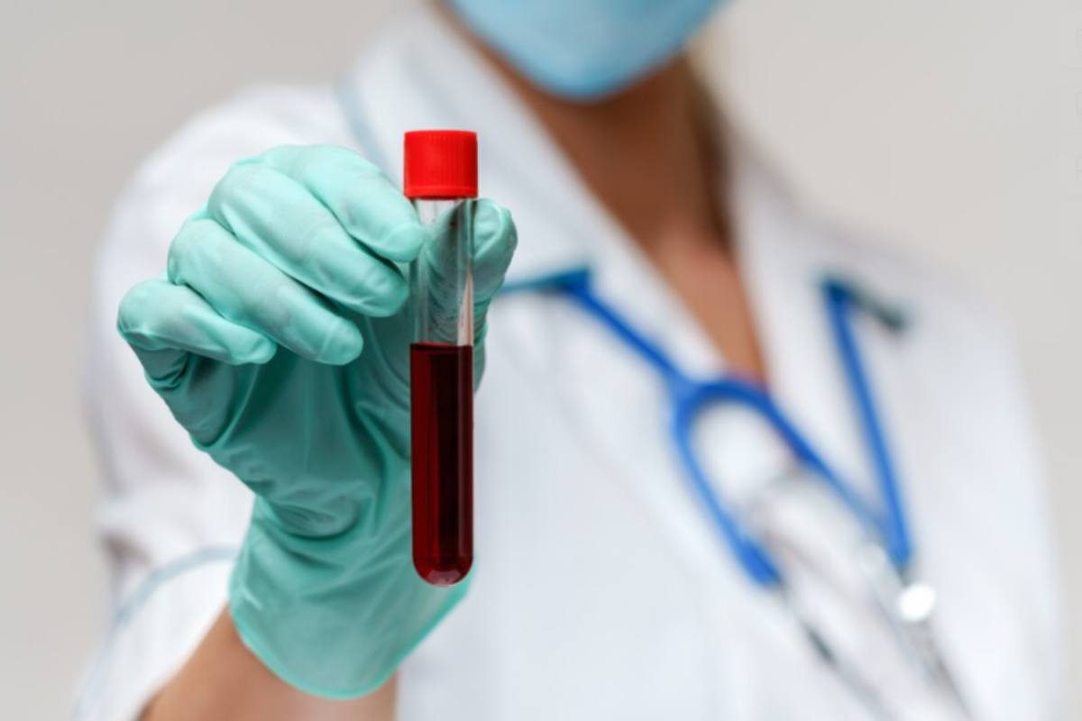 Esami del sangue