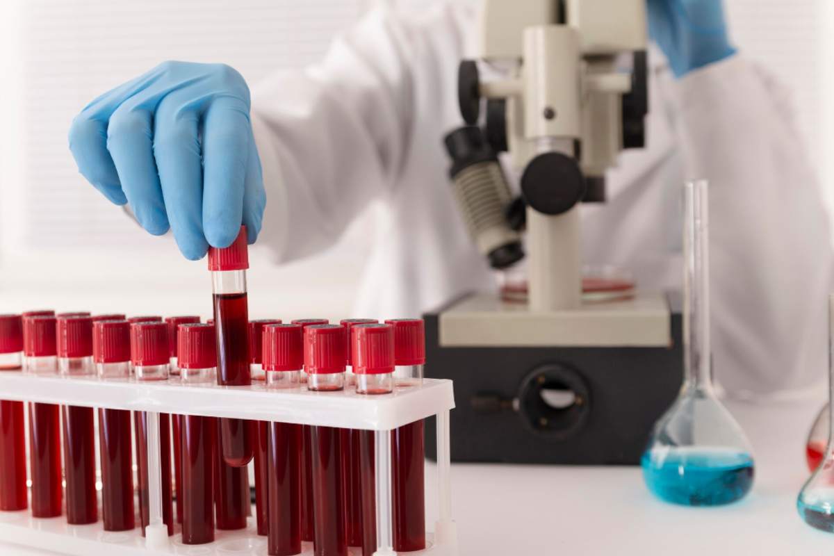 Esami del sangue